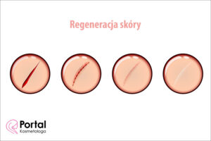 Regeneracja skóry