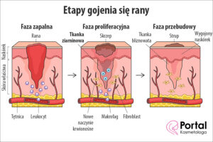 Tkanka ziarninowa