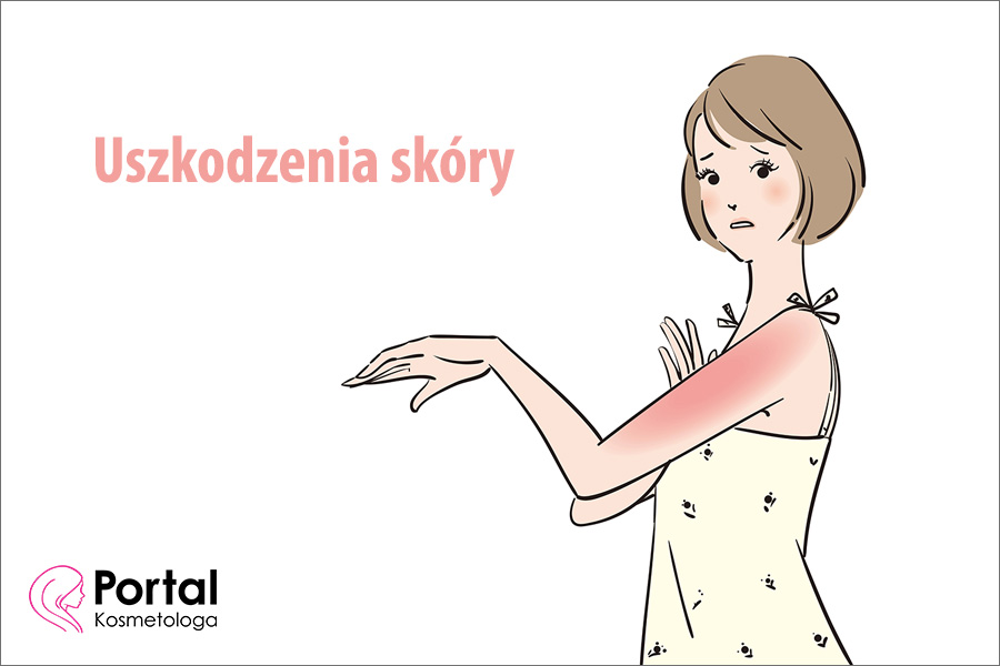 Uszkodzenia skóry