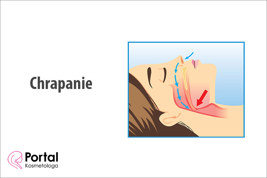 Chrapanie