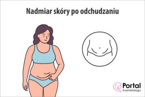 Nadmiar skóry po odchudzaniu