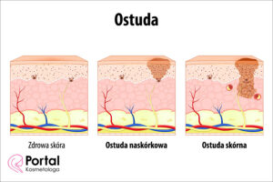 Ostuda