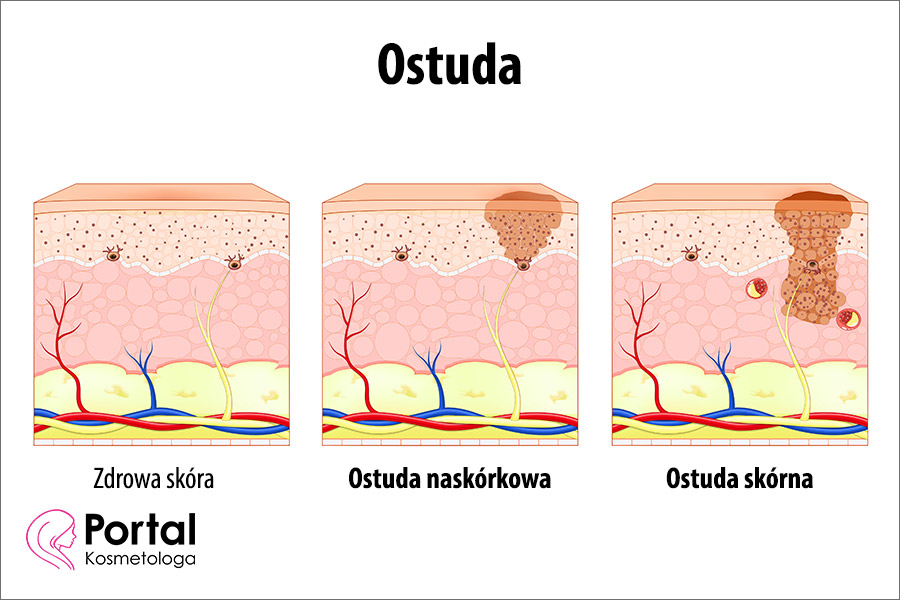 Ostuda