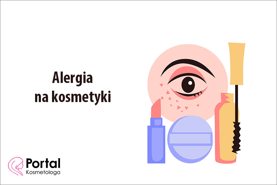 Alergia na kosmetyki