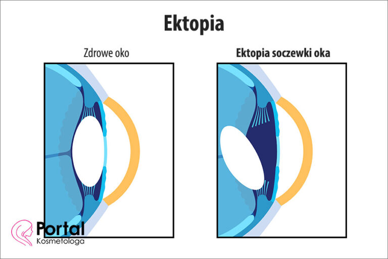 Ektopia