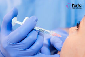 Gdzie wstrzykuje się kwas hialuronowy?