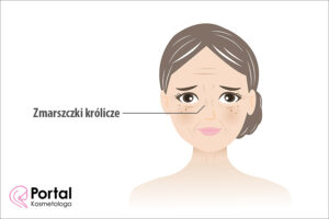 Zmarszczki królicze