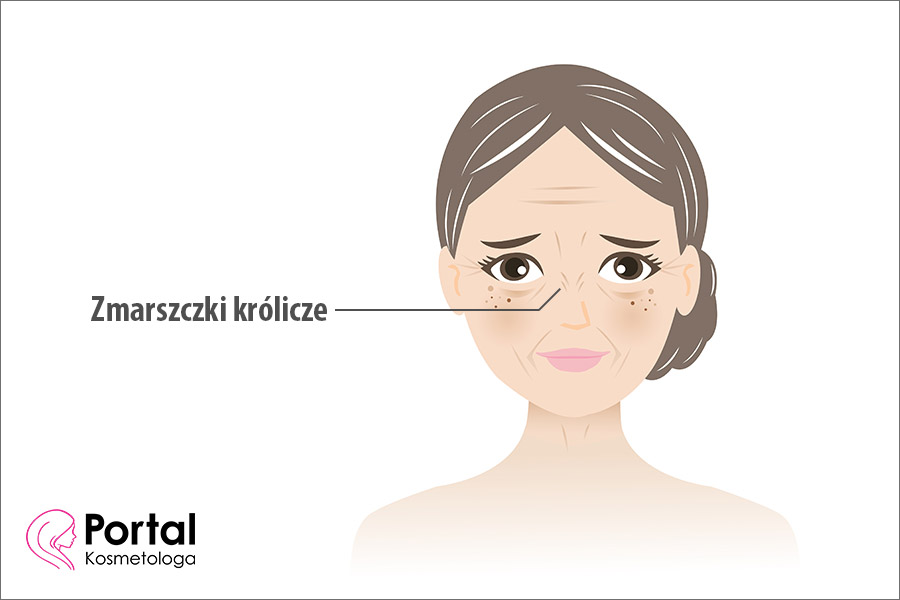 Zmarszczki królicze