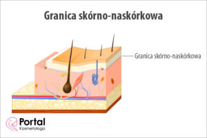Granica skórno‑naskórkowa