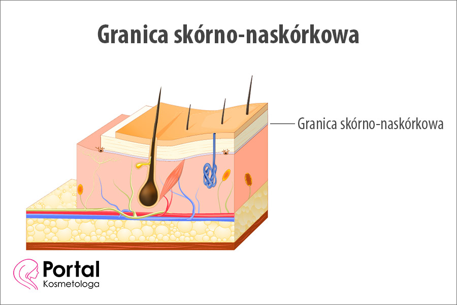 Granica skórno‑naskórkowa