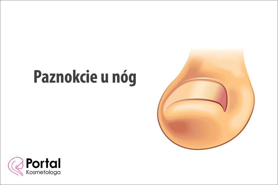 Paznokcie u nóg