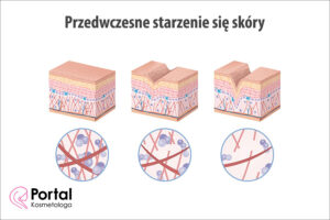 Przedwczesne starzenie się skóry