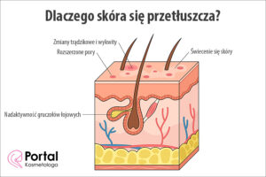Dlaczego skóra się przetłuszcza?