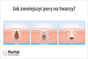 Jak zmniejszyć pory na twarzy?