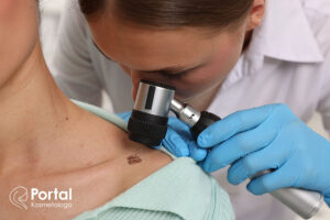 Leczenie dermatologiczne