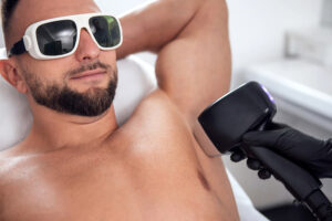 Plecy, klatka piersiowa, kark – depilacja laserowa u mężczyzn krok po kroku