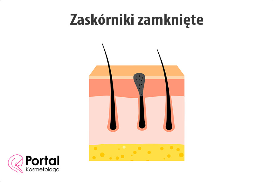 Zaskórniki zamknięte