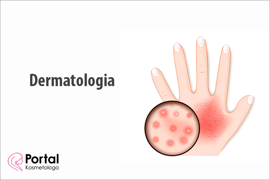 Dermatologia