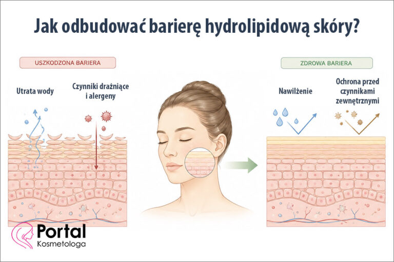 Jak odbudować barierę hydrolipidową skóry?