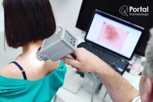 Wideodermatoskopia
