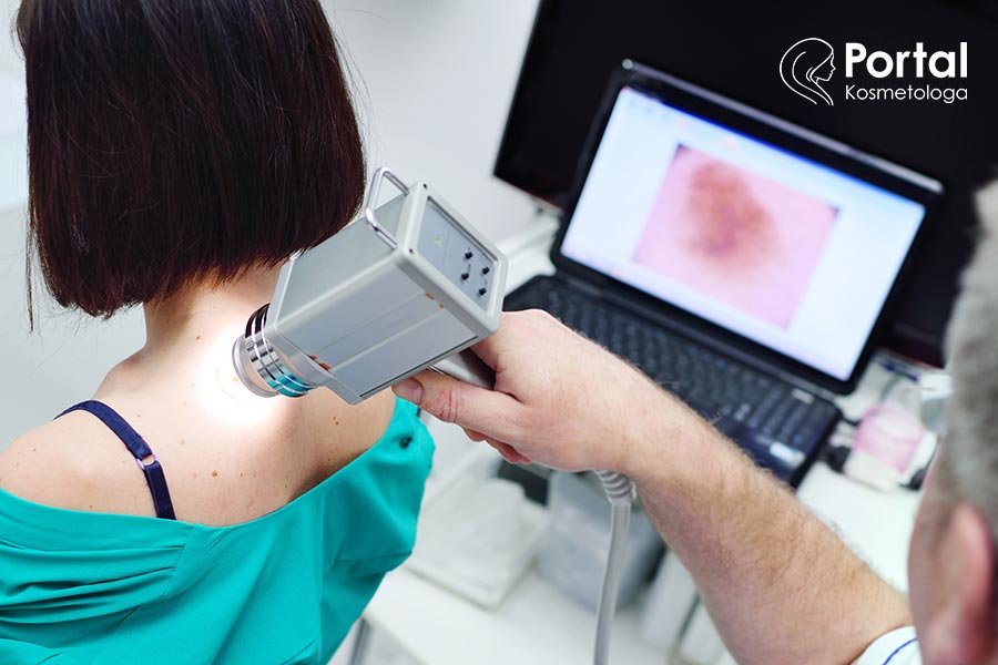 Wideodermatoskopia