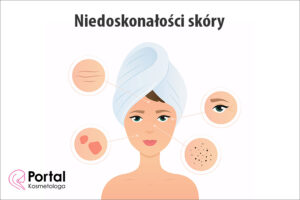 Niedoskonałości skóry