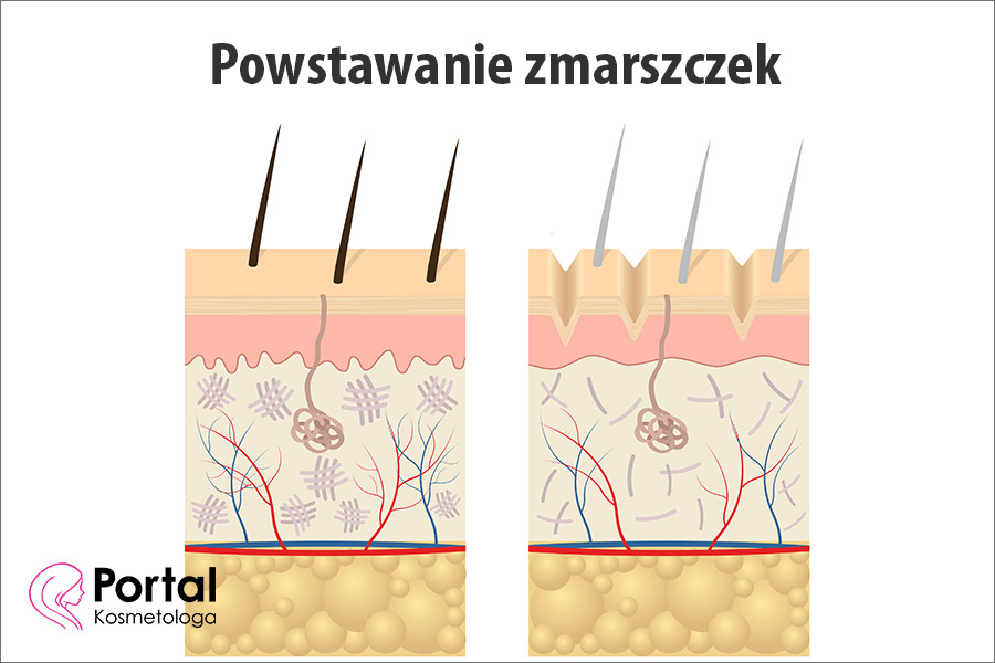 Powstawanie zmarszczek