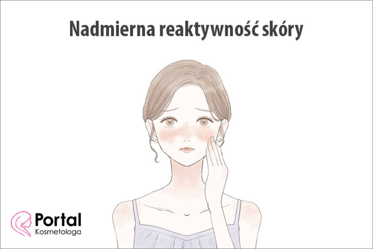 Nadmierna reaktywność skóry