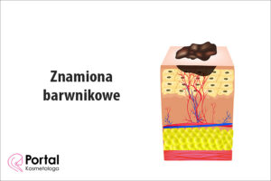 Znamiona barwnikowe