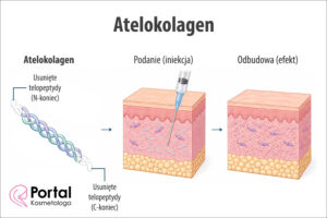 Atelokolagen