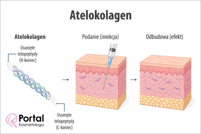 Atelokolagen