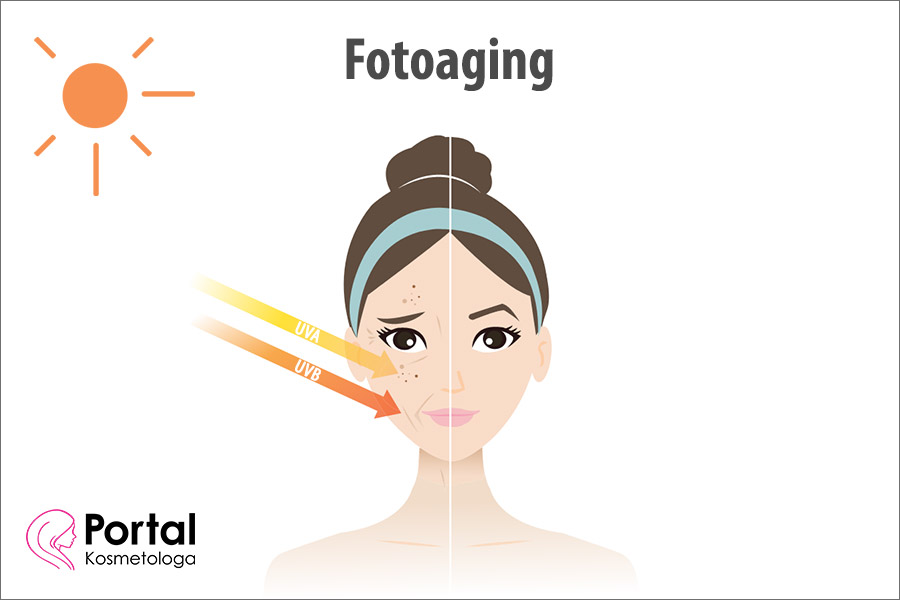 Fotoaging