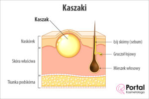 Kaszaki