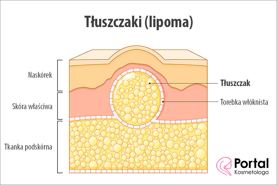 Tłuszczaki