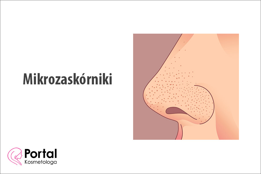 Mikrozaskórniki